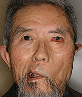 治療前