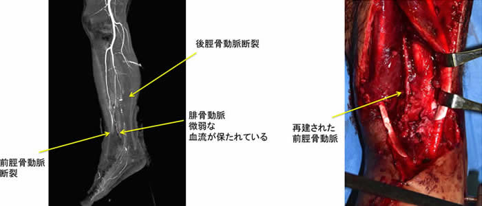 重症外傷